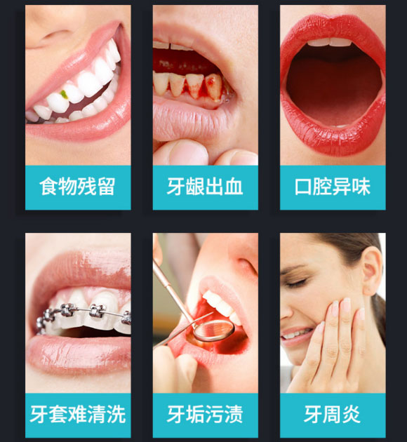 博皓冲牙器,便携式洗牙器